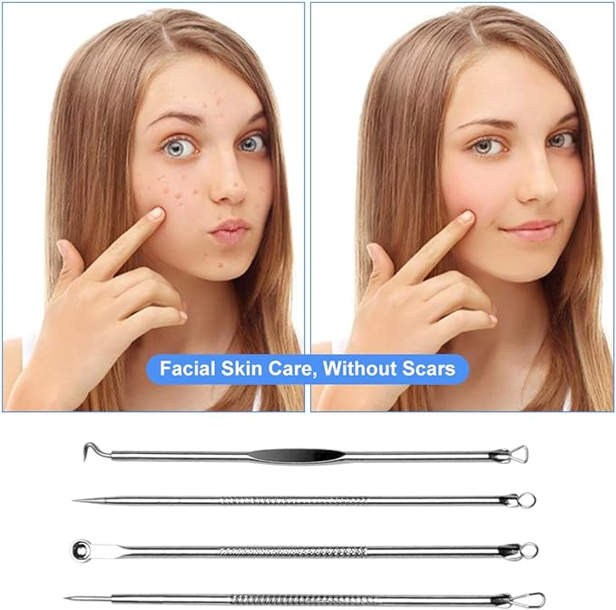 Meishiman - Set Med 4 Acne-Nålar - Hudvårdsverktyg För Borttagning Av Pormaskar